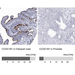 CCDC181 Antibody, Novus Biologicals:Antibodies:Primary Antibodies